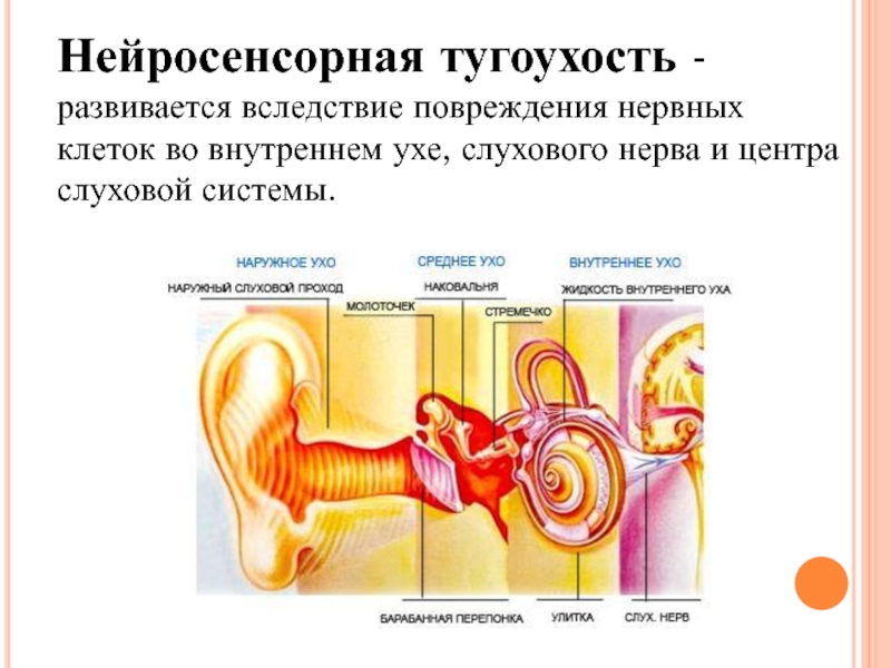 Сенсоневральная тугоухость картинки